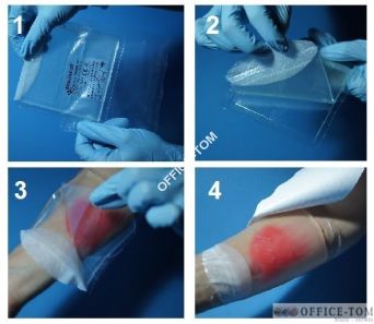 Sterylny opatrunek hydrożelowy Aqua-Gel Q5cm 5sztuk KIKGEL 0988